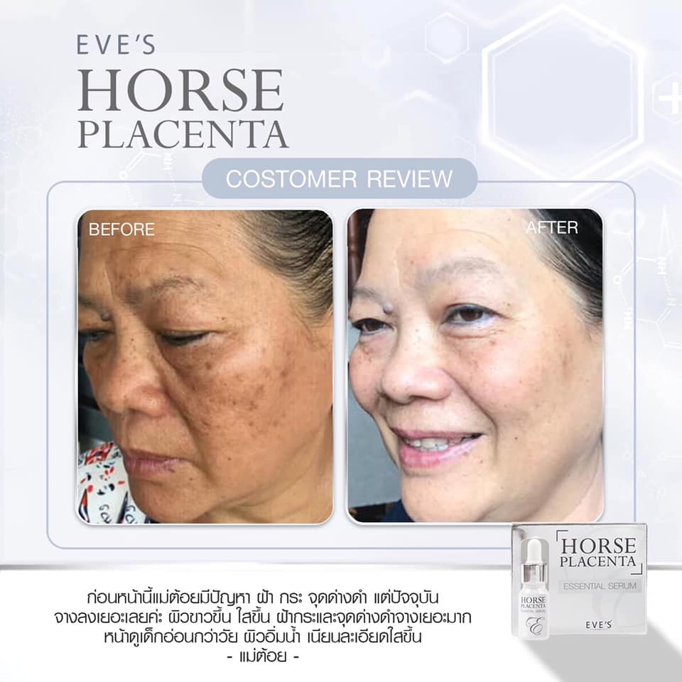 EVE'S HORSE PLACENTA YOUTH SERUM