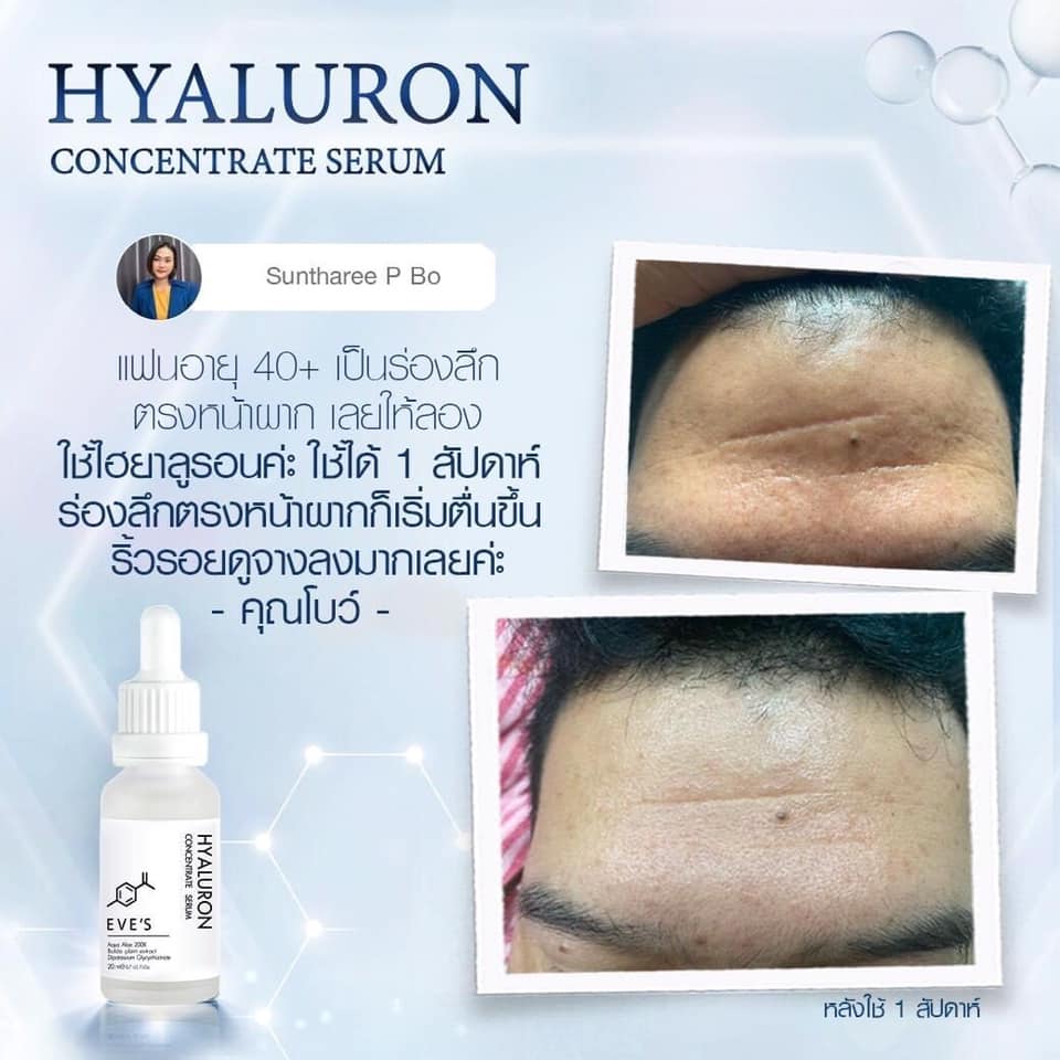 EVE'S HYALURON CONCENTRATE SERUM 8 MOLECULAR