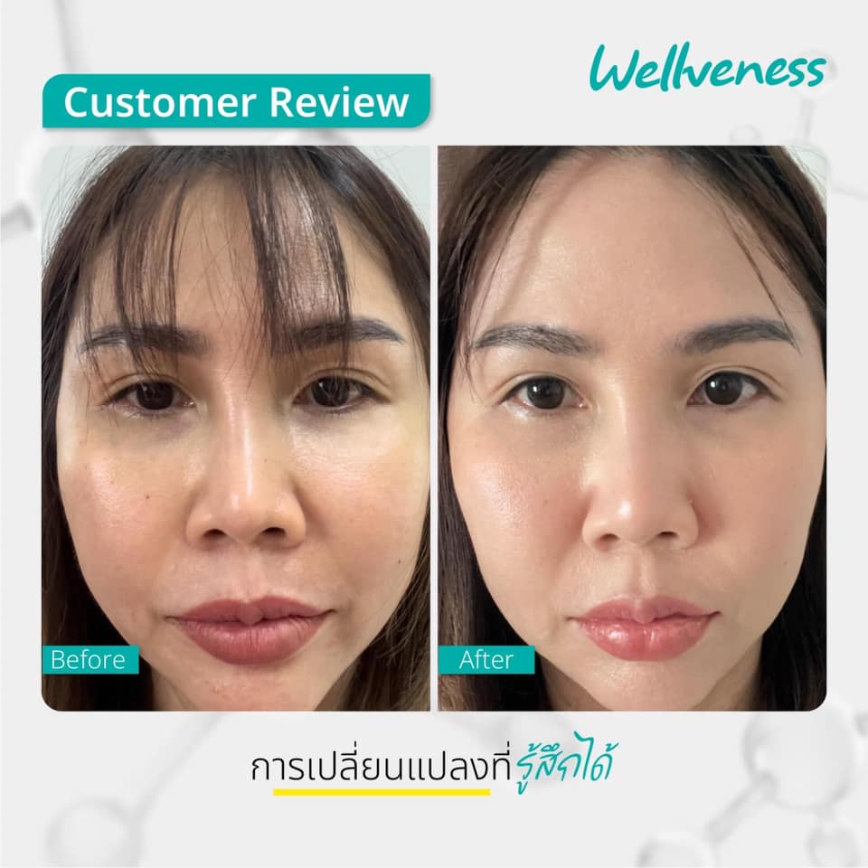 แอมพูล เซรั่ม CUCUMIS NIO-BRIGHT AMPOULE SERUM คูคูมิส นีโอ-ไบร์ท แอมพูล เซรั่ม