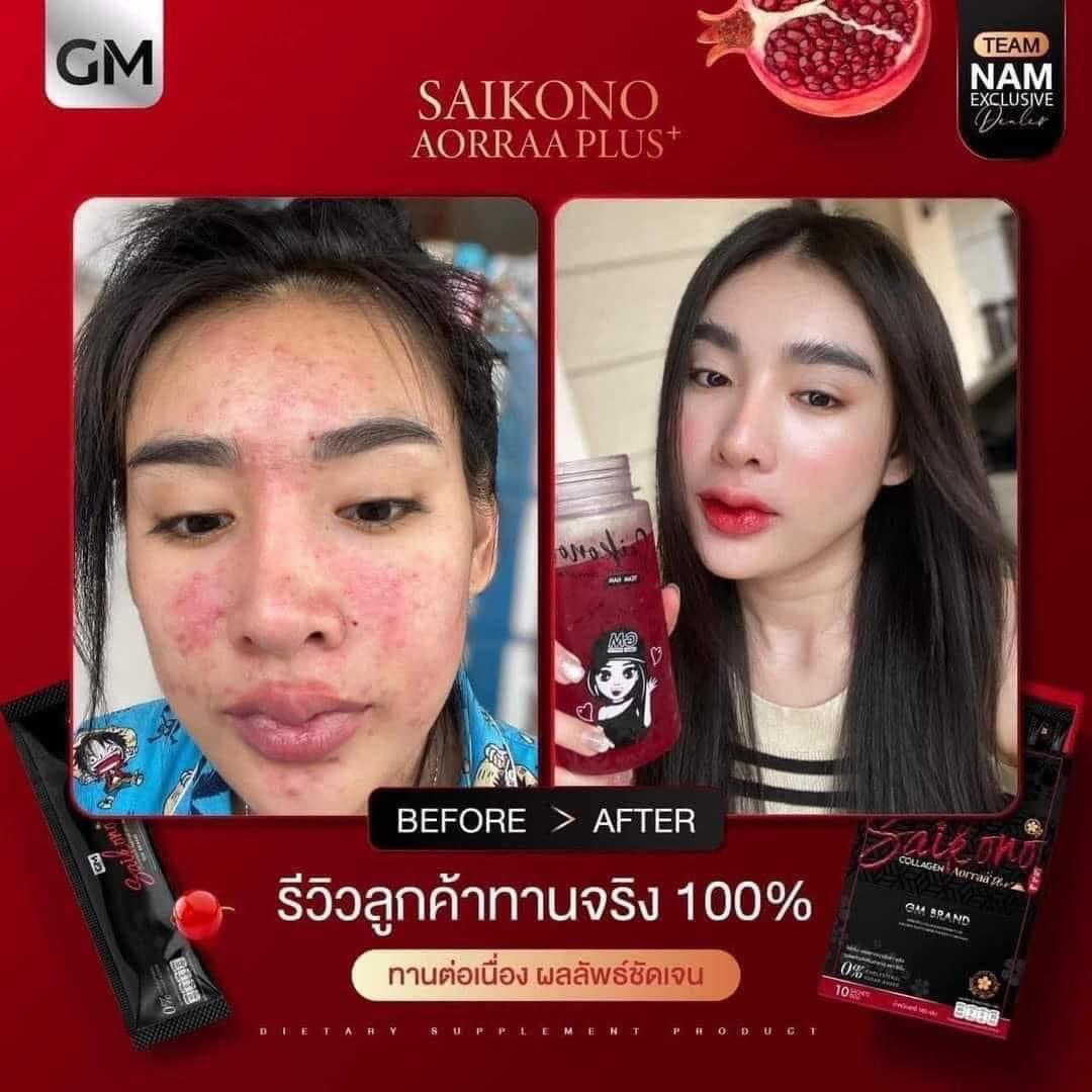 Saikono Collagen Aorra Plus ไซโกโนะ คอลลาเจน เอออร่า พลัส