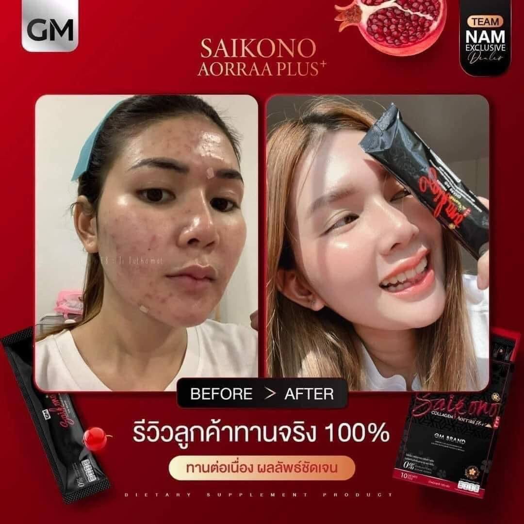 Saikono Collagen Aorra Plus ไซโกโนะ คอลลาเจน เอออร่า พลัส