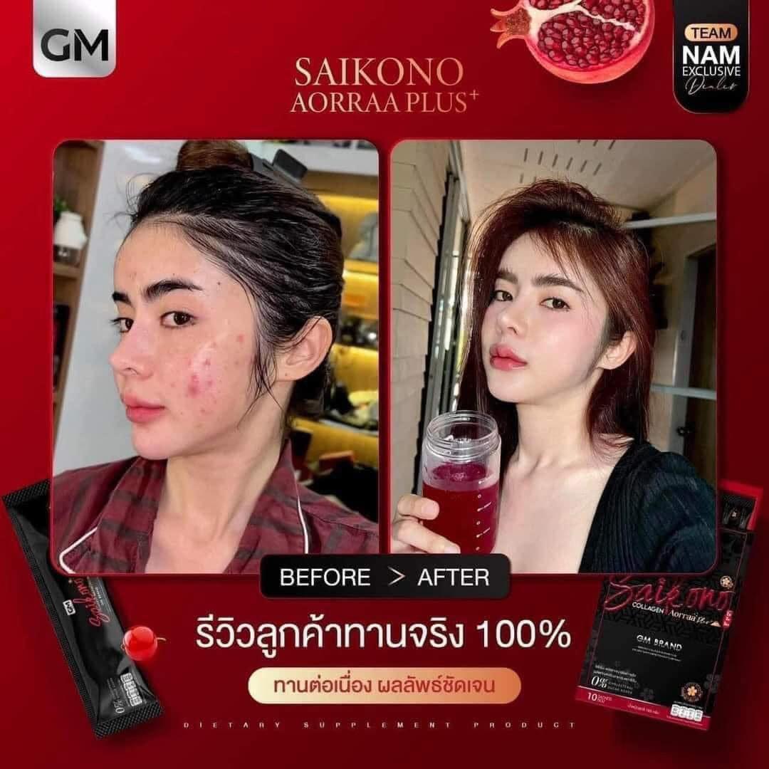 Saikono Collagen Aorra Plus ไซโกโนะ คอลลาเจน เอออร่า พลัส