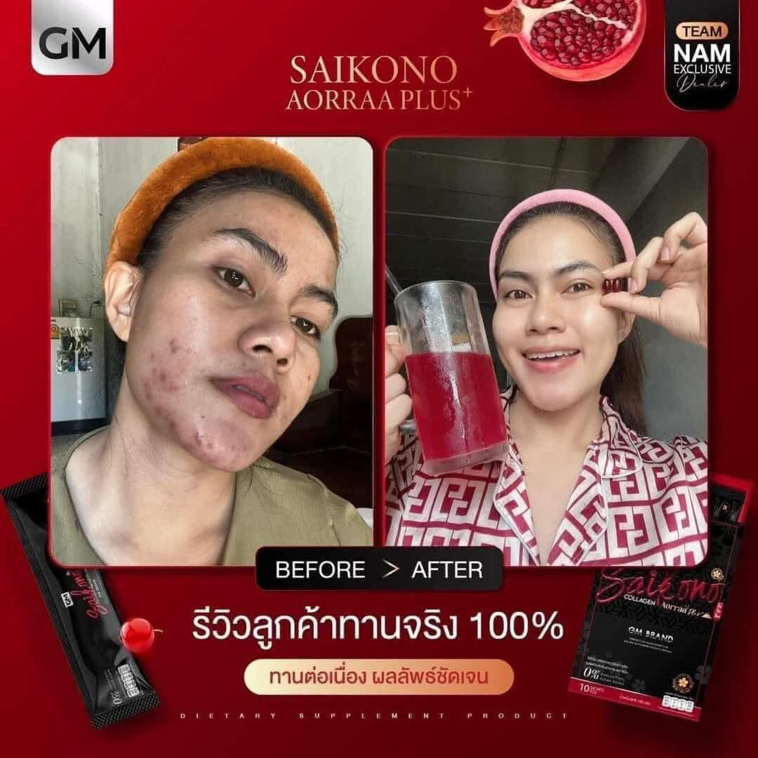 Saikono Collagen Aorra Plus ไซโกโนะ คอลลาเจน เอออร่า พลัส