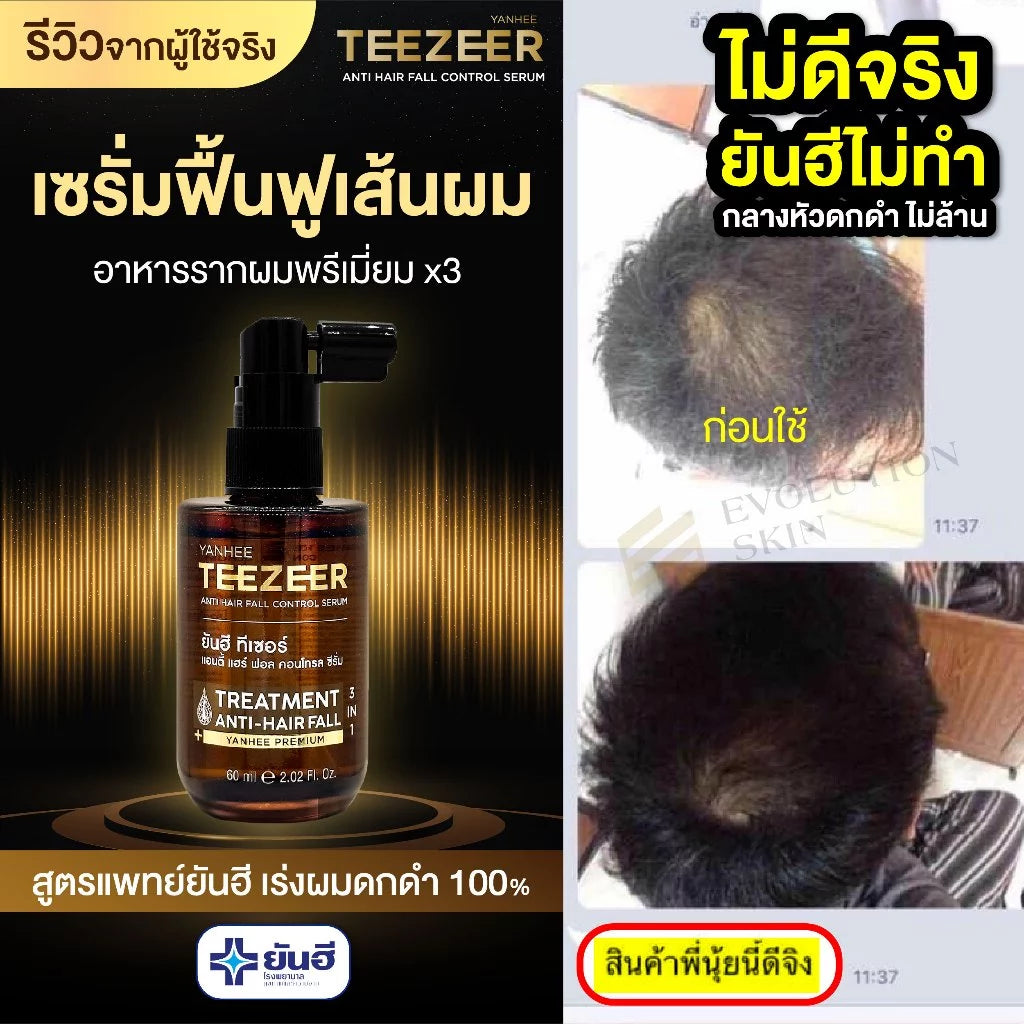 Yanhee Teezeer Anti Hair Fall Control Serum